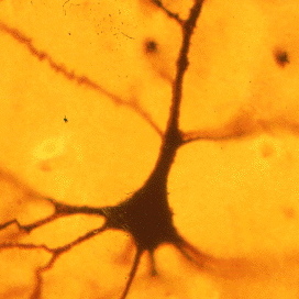 Golgi-stained neuron